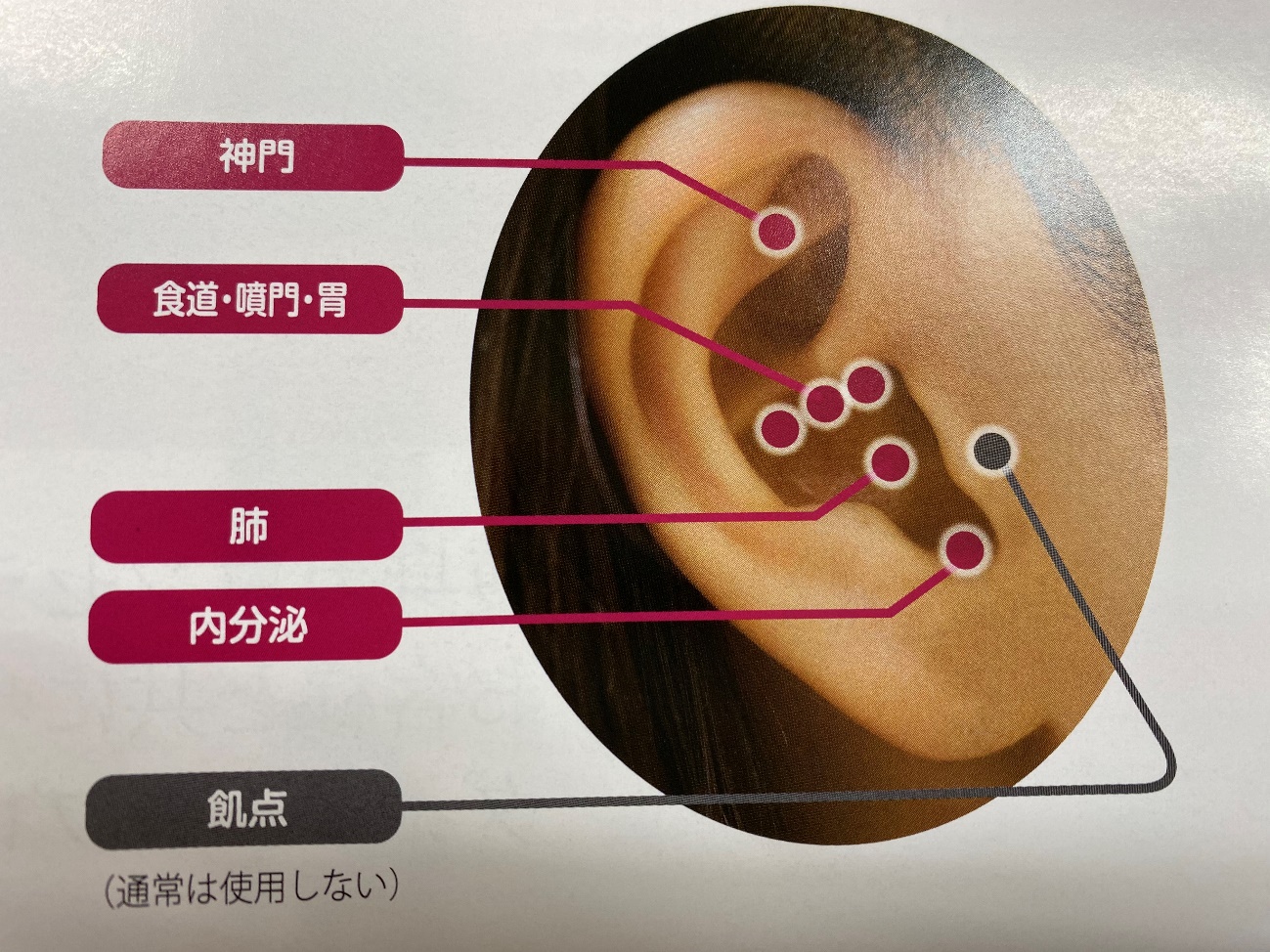 ダイエットや体質改善の耳つぼの位置は 場所を図で解説 Column