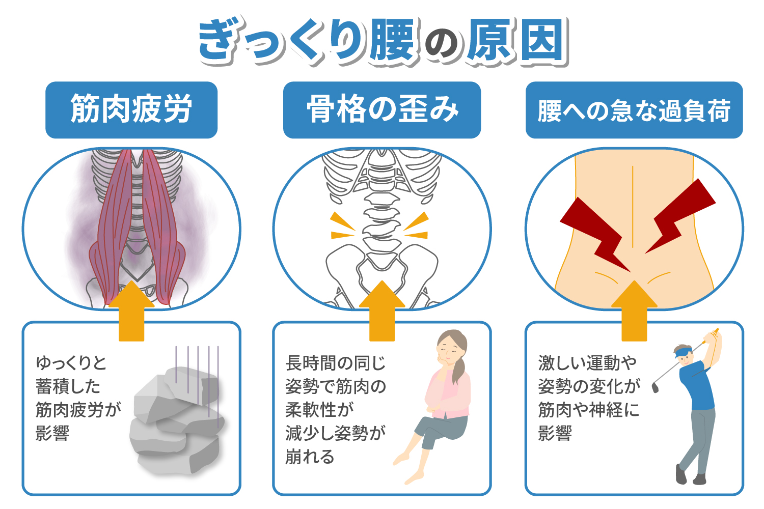 ぎっくり腰の原因とは？ 痛みへの対処法や腰痛を予防する方法を解説 - 小林整骨院の体の悩み痛み改善コラム