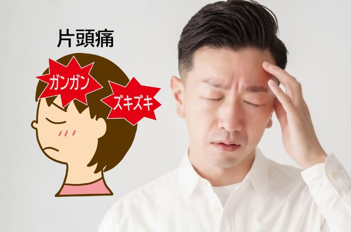 片頭痛