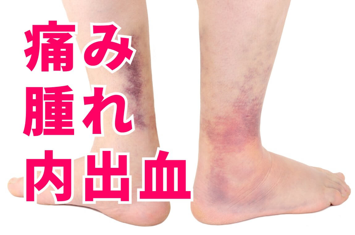 足首の痛み・腫れ・内出血